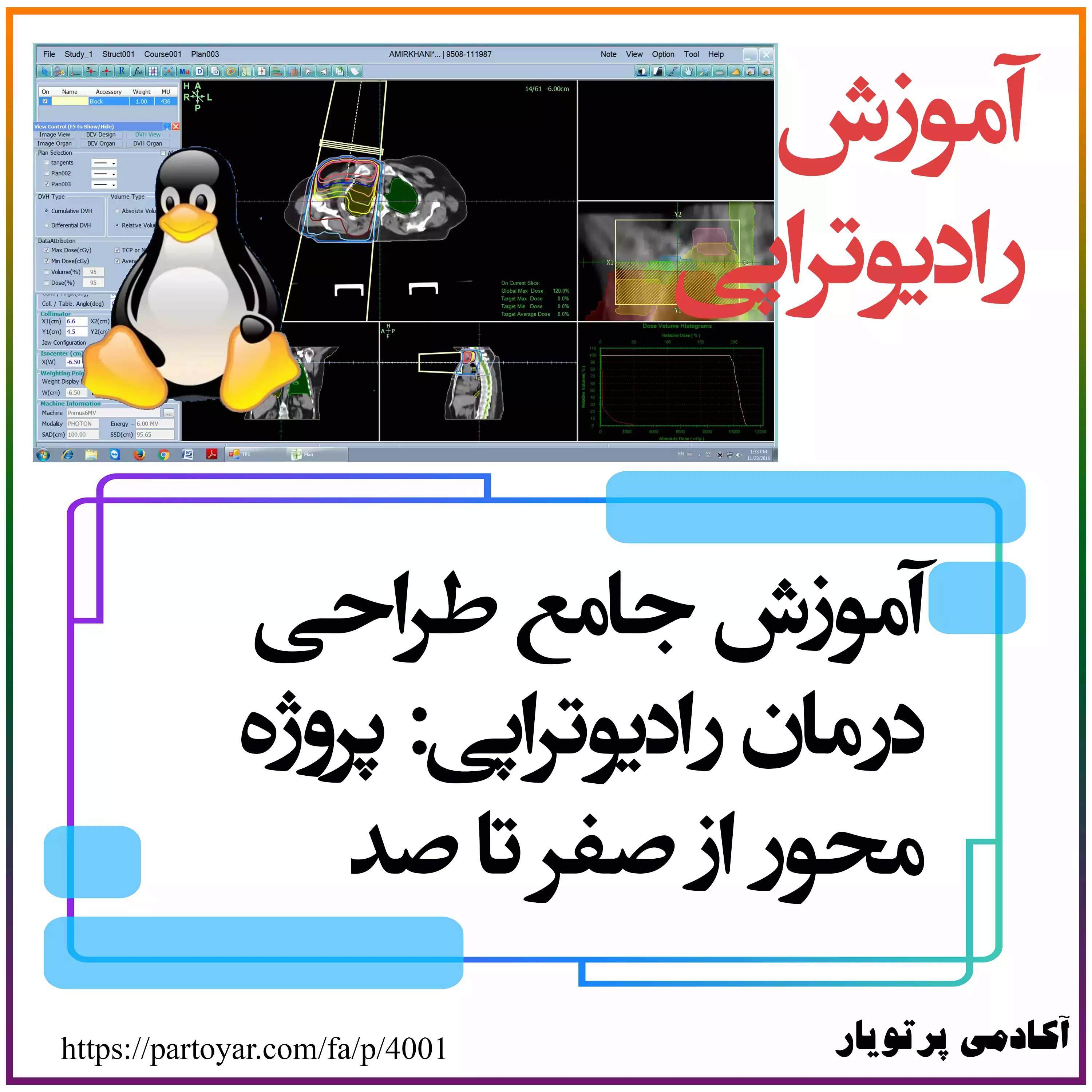 آموزش جامع طراحی درمان رادیوتراپی: پروژه محور از صفر تا صد